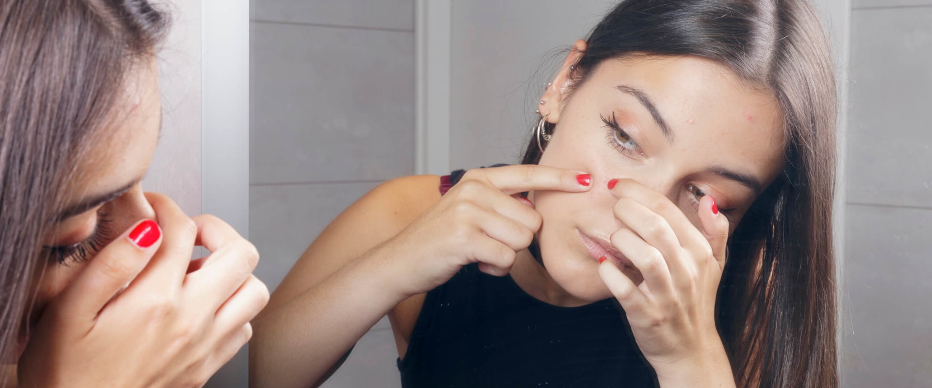 How to Avoid Picking or Popping Pimples for Clear, Acne-Free Skin