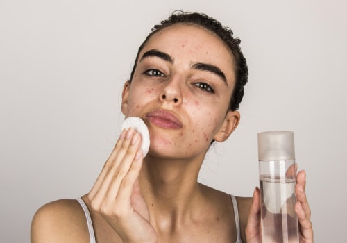 Cleansing for Acne-Prone Skin: How to Clear Your Skin and Prevent Future Breakouts