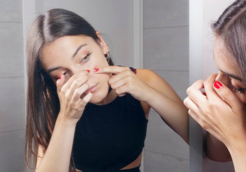 How to Avoid Picking or Popping Pimples for Clear, Acne-Free Skin